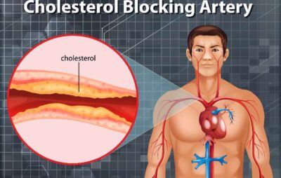 reduced 1000055975 1